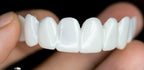 Snap-On Cosmetic Veneers | Instant Smile Cover for Imperfections