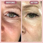RadiantLift Eye Cream | Brighten, Lift & Smooth for Youthful Eyes