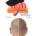 Home Laser Cap For Hair Growth With Red And Infrared Light