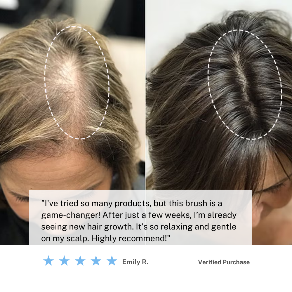 コードレス頭皮マッサージブラシ | 自宅で髪の健康とリラクゼーションをサポート