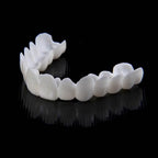 قشور نوفابرايت القابلة للتركيب للأسنان العلوية والسفلية ابتسامة طبيعية فورية