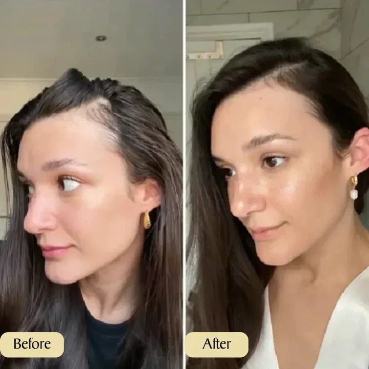 Marvella Natürliches Haarwuchsmittel | Petprovac