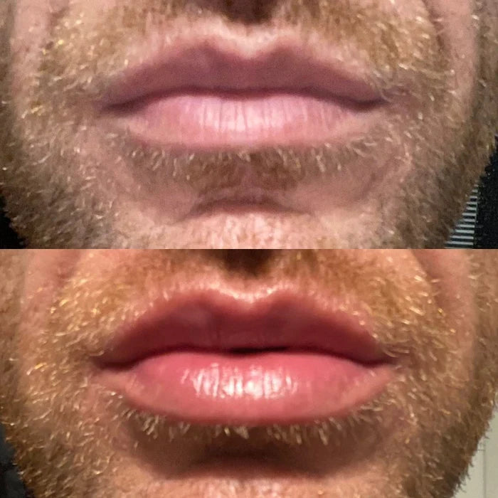 Ser pentru buze LumaGlow Instant Lip Plumper pentru buze mai pline acum