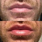 Ser pentru buze LumaGlow Instant Lip Plumper pentru buze mai pline acum