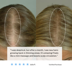 コードレス頭皮マッサージブラシ | 自宅で髪の健康とリラクゼーションをサポート