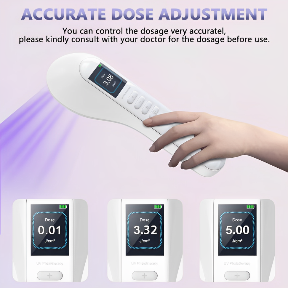 VitaLuma 308nm UVB Vitiligo Phototherapy Lamp for Home Use