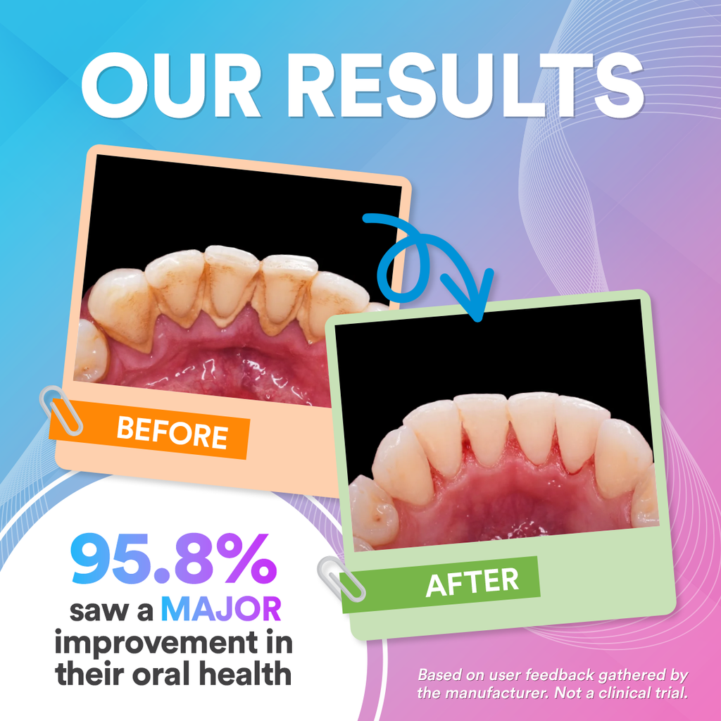 Vízsugaras fogköztisztító Pro – Erő, Pontosság és Teljes Frissesség