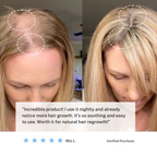 コードレス頭皮マッサージブラシ | 自宅で髪の健康とリラクゼーションをサポート