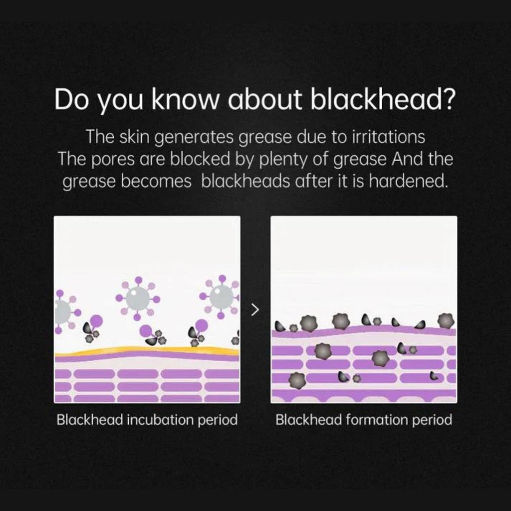 מסכת ניקוי נקבוביות | Petprovac