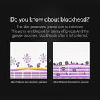 מסכת ניקוי נקבוביות | Petprovac