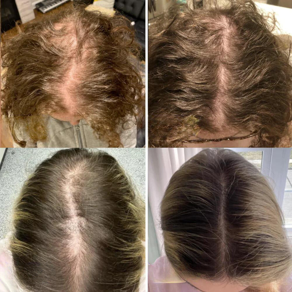 Aceite nutritivo para el cuero cabelludo AureaGrow para ayudar al cabello fino