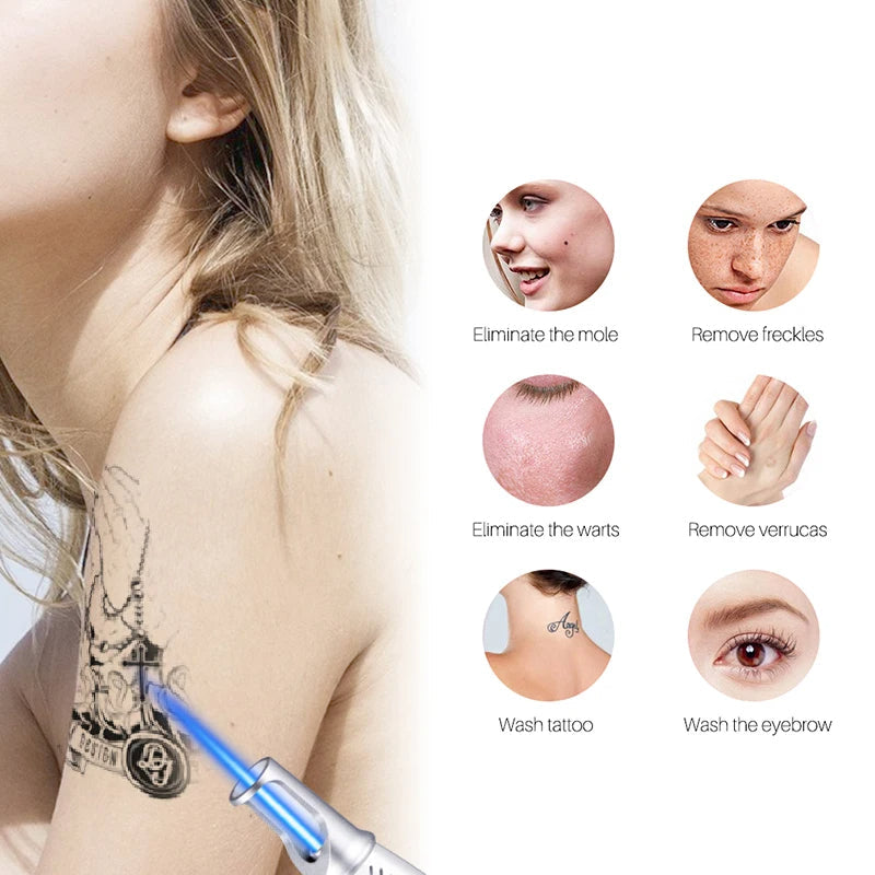 LumiDerm Laser Pen for Tattoo, Moles & Freckles Removal