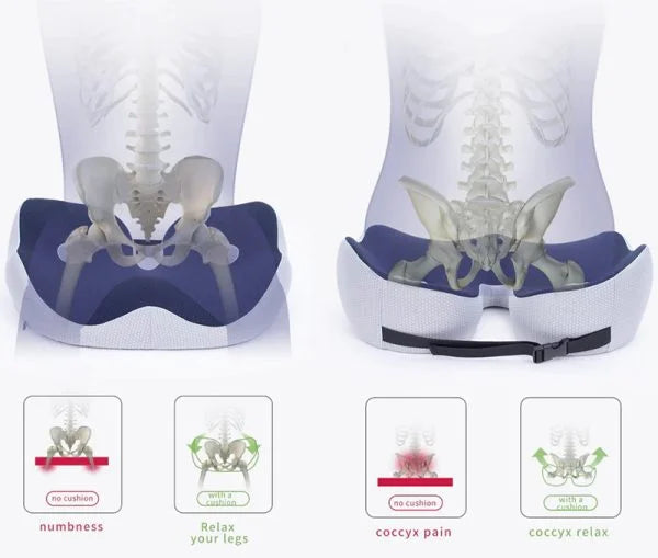 Mukautettava muistivaahtotyyny istuinkohdalle luukivun lievitykseen
