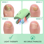 Laser Nail Care System With Triple Wavelength For Toenails And Fingernails