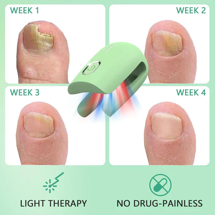 Laser Nail Care System With Triple Wavelength For Toenails And Fingernails