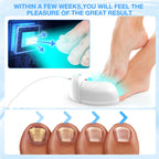 LED Nail Care Device With Blue And Infrared Light For Hands And Feet