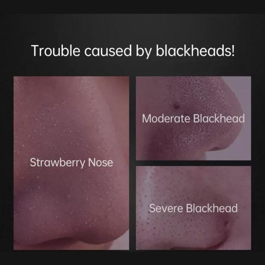 מסכת ניקוי נקבוביות | Petprovac