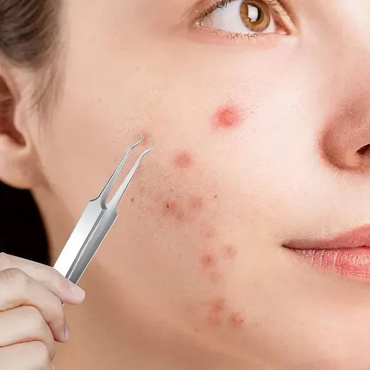 Kit Aurella pentru Îndepărtarea Coșurilor și Părului de pe Față, Set de 3 cu Cutie | Petprovac