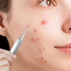 Kit Aurella pentru Îndepărtarea Coșurilor și Părului de pe Față, Set de 3 cu Cutie | Petprovac