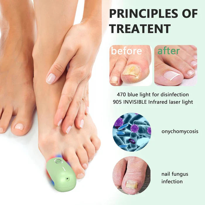 Laser Nail Care System With Triple Wavelength For Toenails And Fingernails