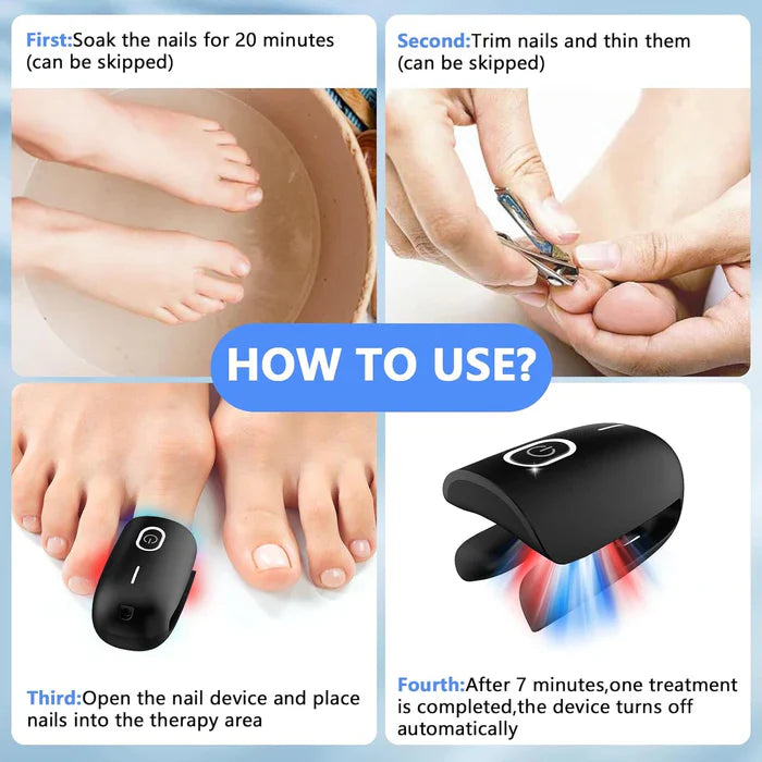 Laser Nail Care System With Triple Wavelength For Toenails And Fingernails