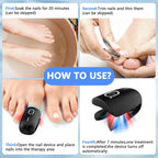 Laser Nail Care System With Triple Wavelength For Toenails And Fingernails