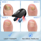 Laser Nail Care System With Triple Wavelength For Toenails And Fingernails