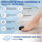 Laser Nail Care System With Triple Wavelength For Toenails And Fingernails