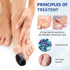 Laser Nail Care System With Triple Wavelength For Toenails And Fingernails