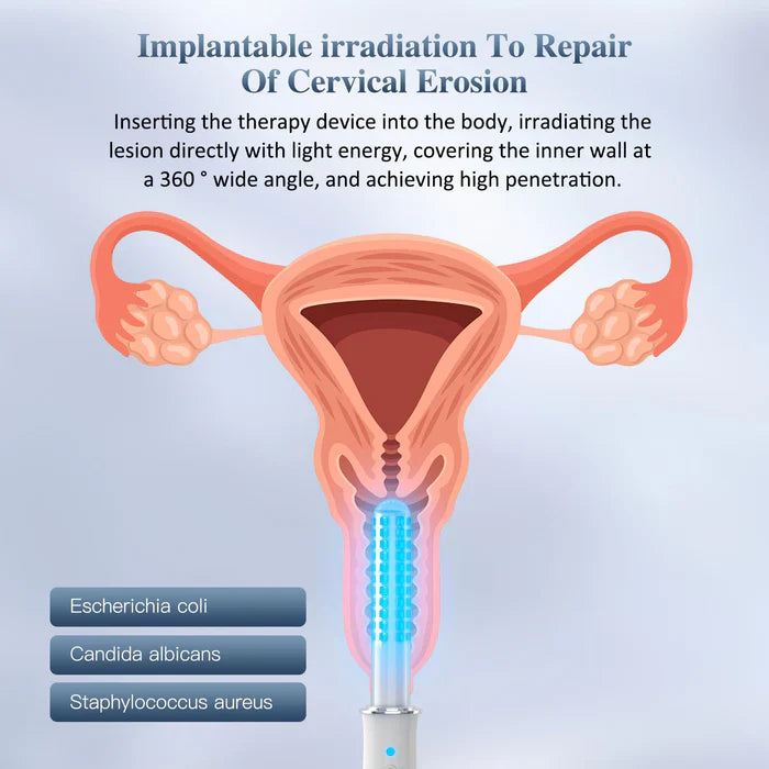 Women's Vibration Light Therapy Wand With Smart Timer