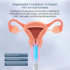 Women's Vibration Light Therapy Wand With Smart Timer