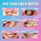 Ultralyds Tandrenser – Avanceret Smilteknologi