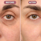 RadiantLift Eye Cream | Brighten, Lift & Smooth for Youthful Eyes