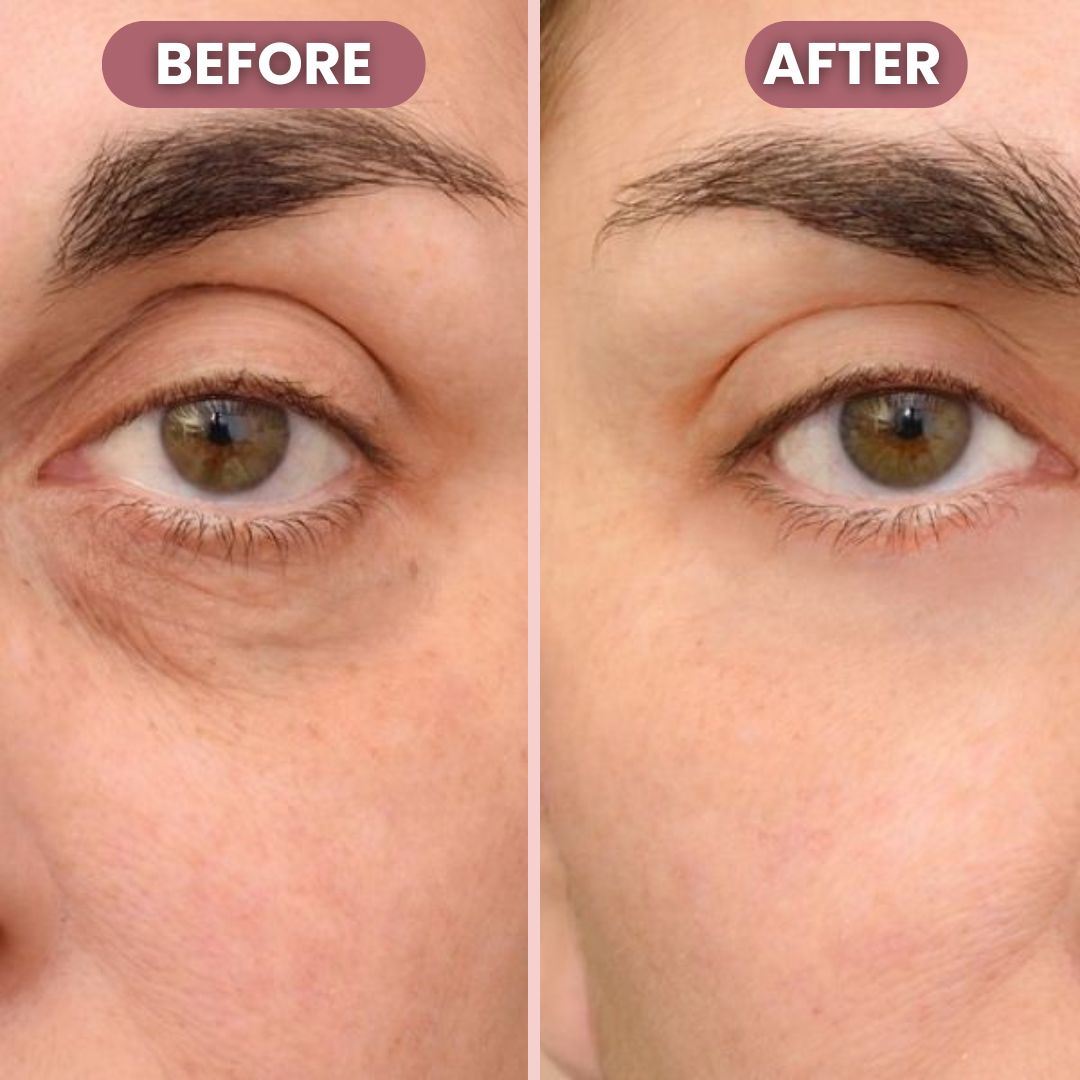 RadiantLift Eye Cream | Brighten, Lift & Smooth for Youthful Eyes