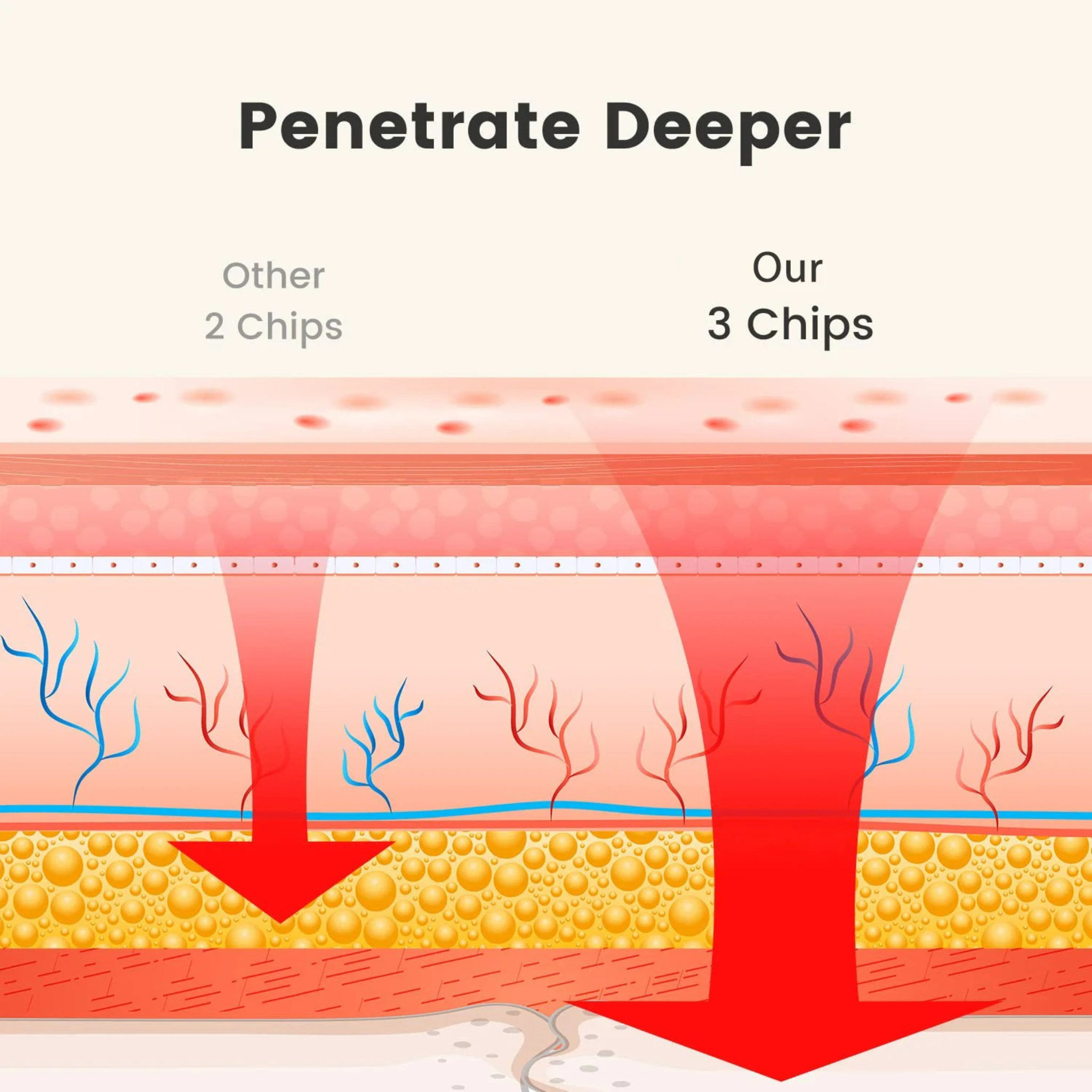 Tali Pinggang Terapi Cahaya Merah VitaRay untuk Pengurangan Lemak di Rumah