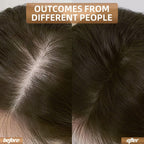 REGENVIE Pro At Home Hair Renewal Solution For Lasting Density