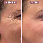 RadiantLift Eye Cream | Brighten, Lift & Smooth for Youthful Eyes