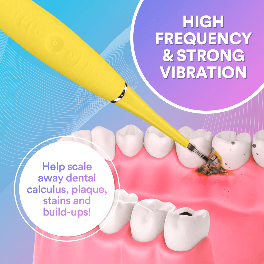 Ultralyds Tandrenser – Avanceret Smilteknologi