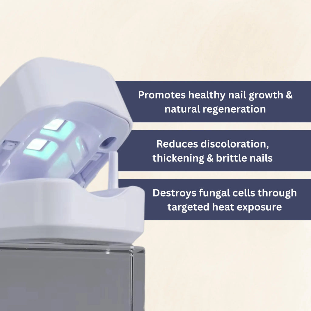 Peranti Terapi Kuku UV Mudah Alih LuminaNail untuk Penjagaan di Rumah