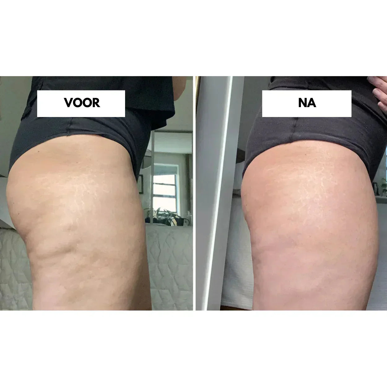 CelluLift Deep Tissue Vacuum Massage for Firmer Skin