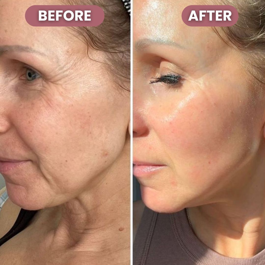 RadiantLift Eye Cream | Brighten, Lift & Smooth for Youthful Eyes