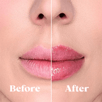 LustraGlow Læbeforstærker