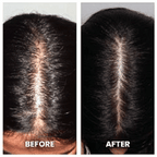 REGENVIE Pro At Home Hair Renewal Solution For Lasting Density