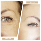 VitaTone 3-in-1 Facial Toning Device | At-Home Lift, Firm & Rejuvenate in 5 Minutes