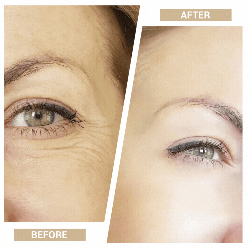 VitaTone 3-in-1 Facial Toning Device | At-Home Lift, Firm & Rejuvenate in 5 Minutes