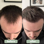 Revitalizador Capilar Pro-Crecimiento en Roll-On para Cabello Fino