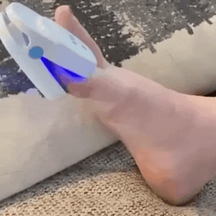 NexaLume At Home Laser Toenail Fungus Treatment Device