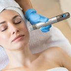 Hydra Pen H3 Mikronakłuwanie z Infuzją Serum dla Miłośników Pielęgnacji Domowej