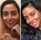 قشور نوفابرايت القابلة للتركيب للأسنان العلوية والسفلية ابتسامة طبيعية فورية