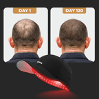 Red LED Light Therapy Cap for Scalp Care & Hair Wellness Routine